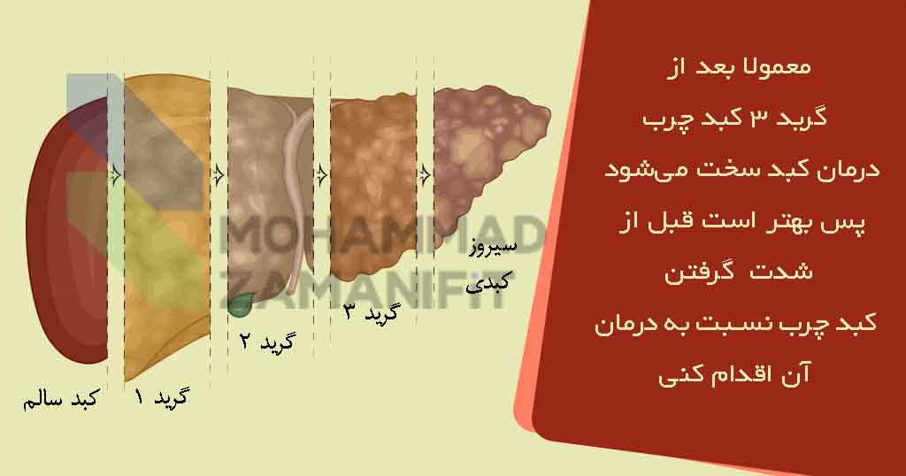 کبد چرب باید قبل از شدت گرفتن بیماری درمان شود